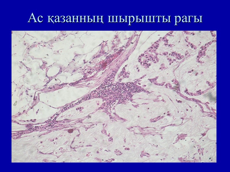 Ас қазанның шырышты рагы